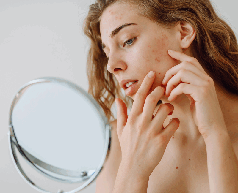 Kobieta ogląda swoją twarz w lustrze – presja idealnego wyglądu w social mediach